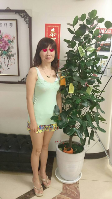 中醫減重,埋線減肥,中醫減肥,埋線減重 中醫埋線減肥,減重,中醫失眠,下背痛,肩頸酸痛,坐骨神經痛,轉大人,小刀針,圓針